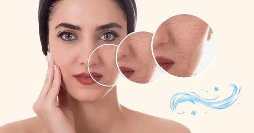 20 Dry Skin Issues People Face In Winters - Wayveda