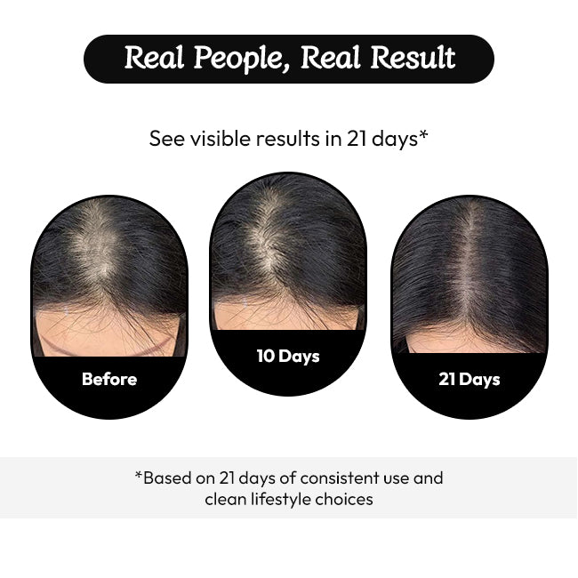 Wayveda Hairfall Control Serum-50ml